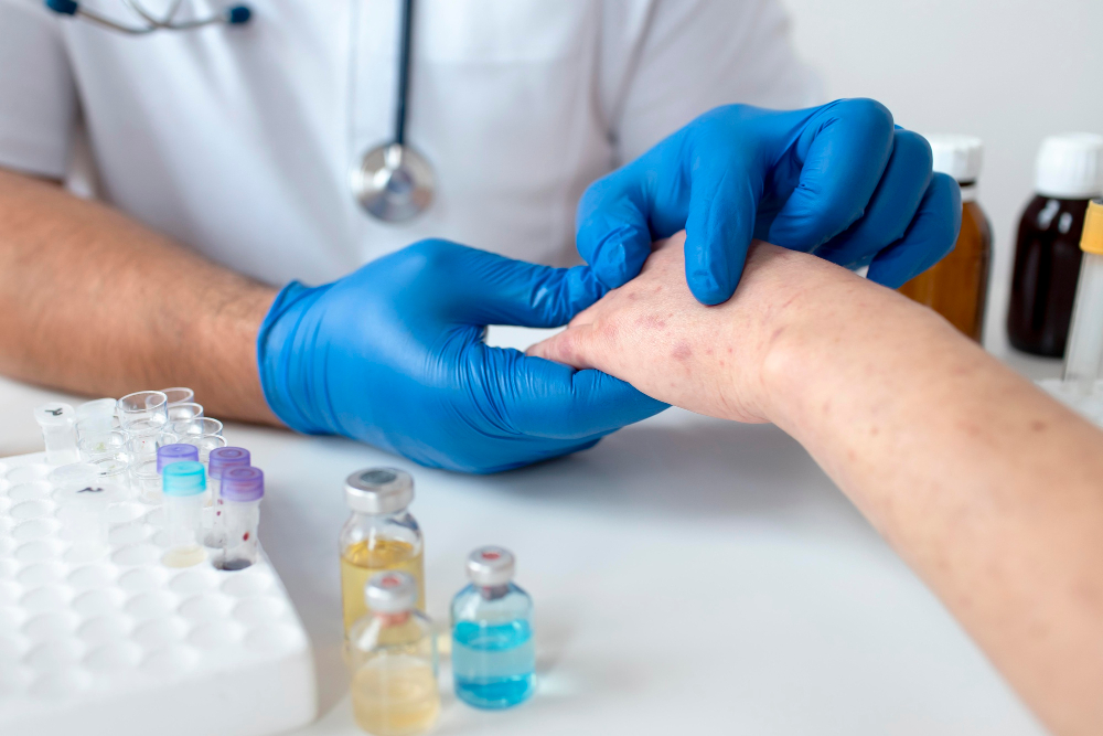 Allergy Testing