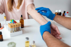 do-dermatologists-do-allergy-testing