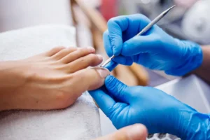 Do you need a referral to see a podiatrist