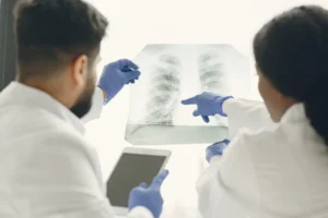 How to Prevent Pulmonary Embolism