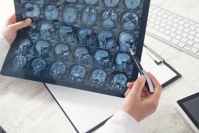 Neurologist diagnosing and treating conditions like migraines and memory disorders at Magnet Health NY, 907 E Tremont Ave and 741 E 233rd St, Bronx, NY