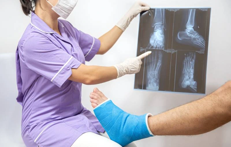 Orthopedic doctor evaluating ankle X-rays and treating injuries at Magnet Health NY, 741 E 233rd St, Bronx, NY 10466