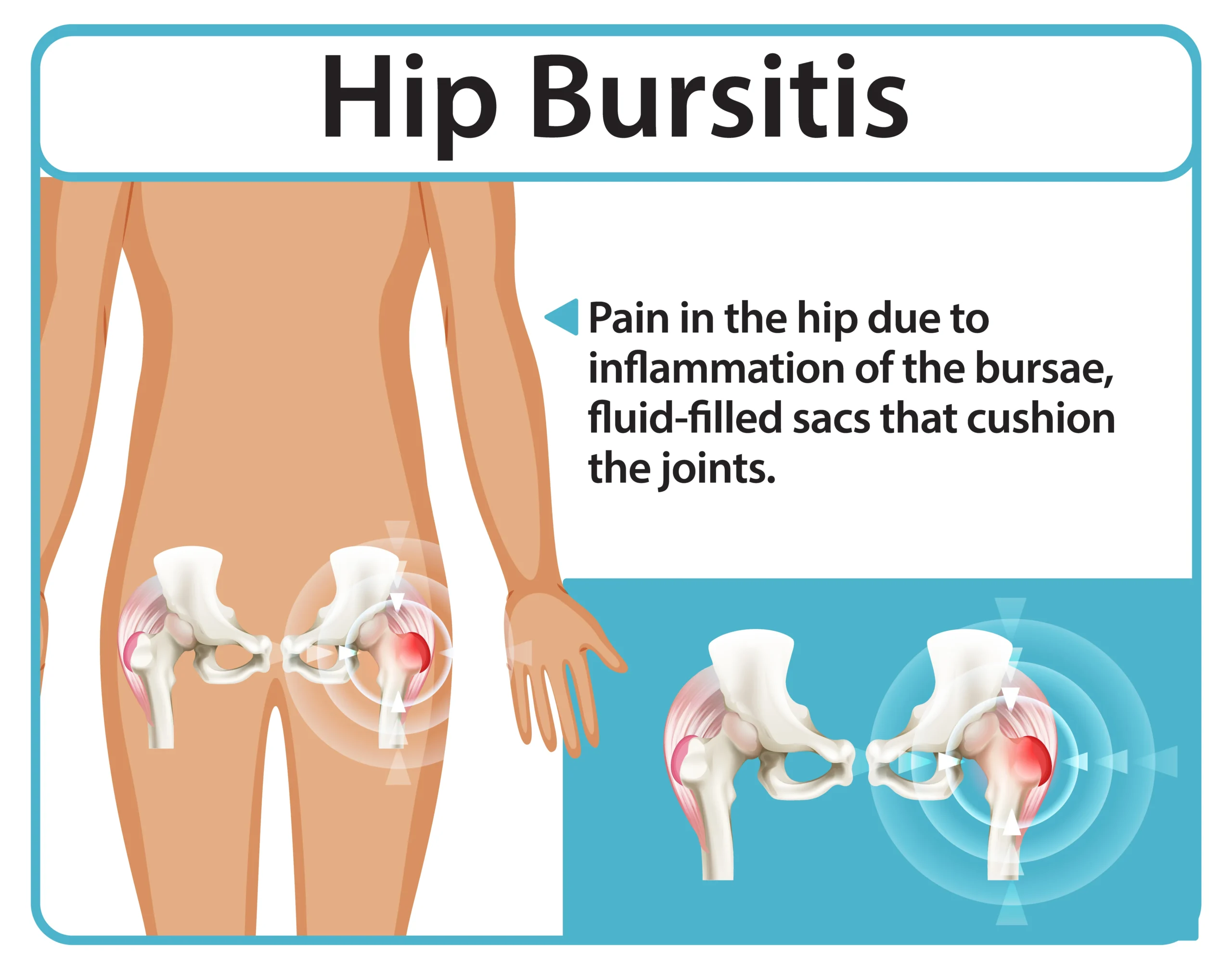 Sacroiliac joint injections for hip and pelvic pain treatment at Magnet Health NY, 907 E Tremont Ave, Bronx, NY 10460