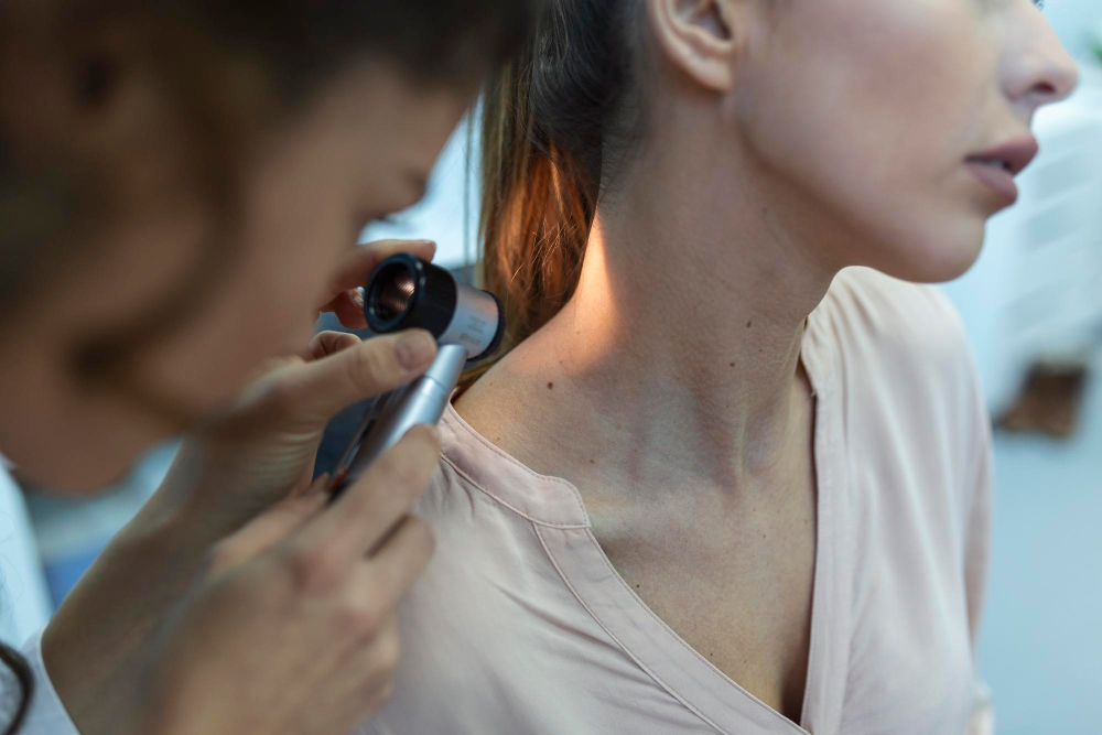 Dermatologist Remove a Cyst
