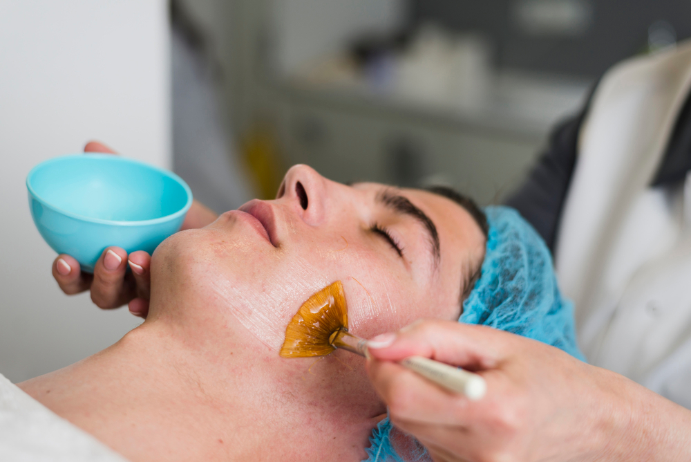 Hyperpigmentation Occur After a Chemical Peel