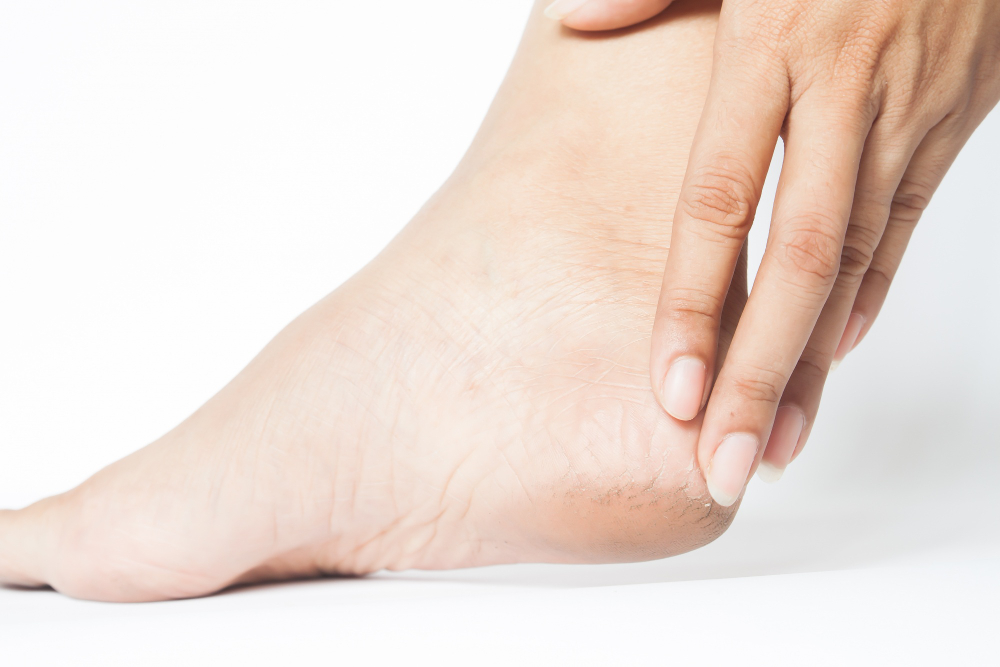 Common Skin Problems Found on the Feet